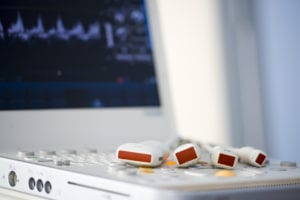 ultrasound machine used for varicose veins