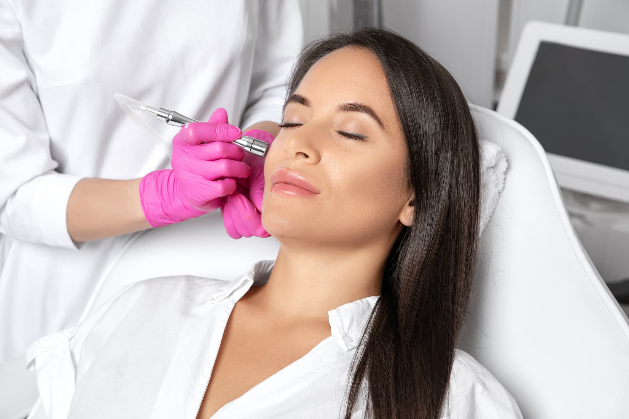 Before & after Image of Dermal Fillers Los Angeles CA