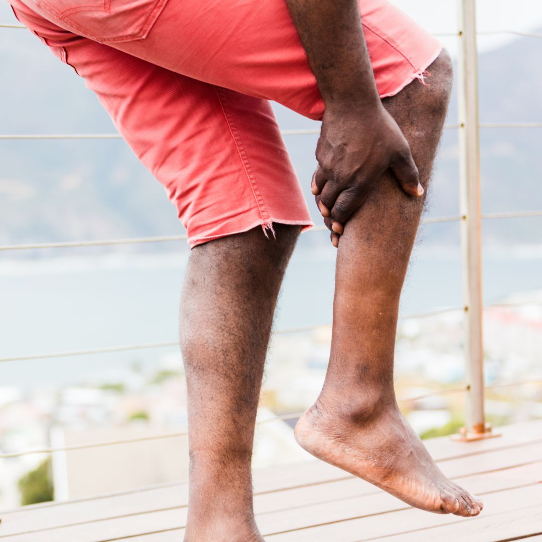 Why Do My Leg Veins Hurt? L.A. Vein Center