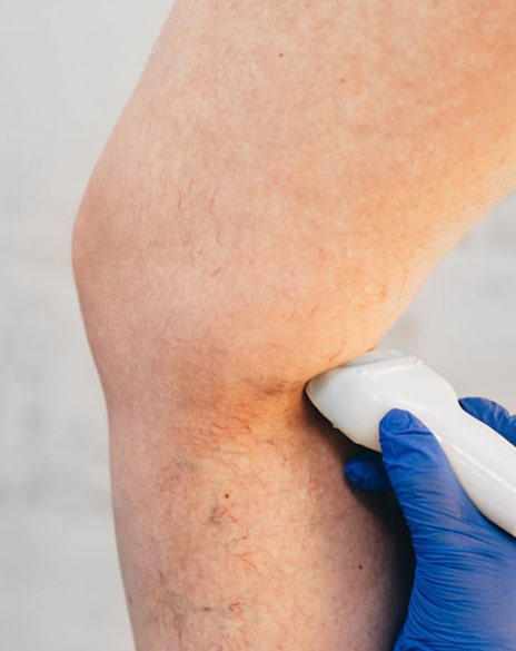 Vein Ultrasounds in Los Angeles
