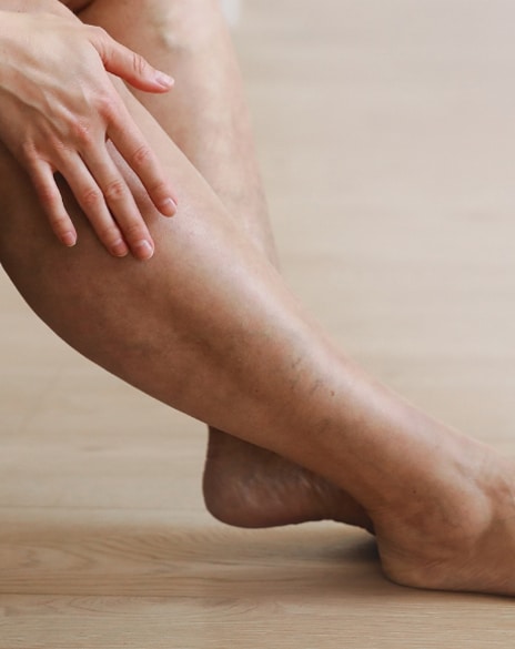 Leg Ulcer Treatment in Los Angeles