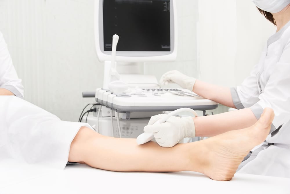 Close up of legs getting vein ultrasound in Los Angeles