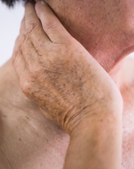 Hand & chest vein Treatment Los Angeles CA