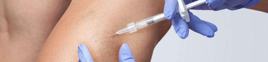 SCLEROTHERAPY IN LOS ANGELES, CA