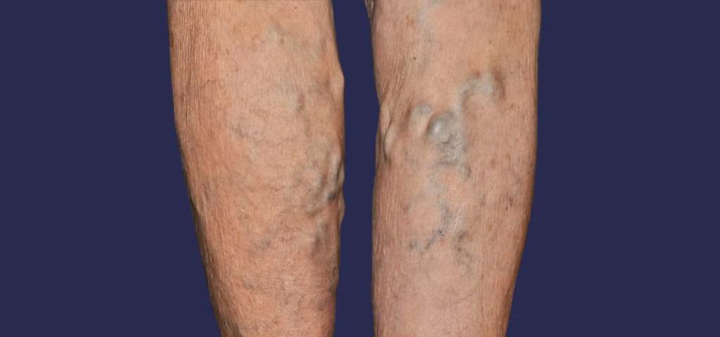 VARITHENA IN LOS ANGELES, CA