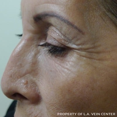 After Image: Facial Treatment - left-front-oblique